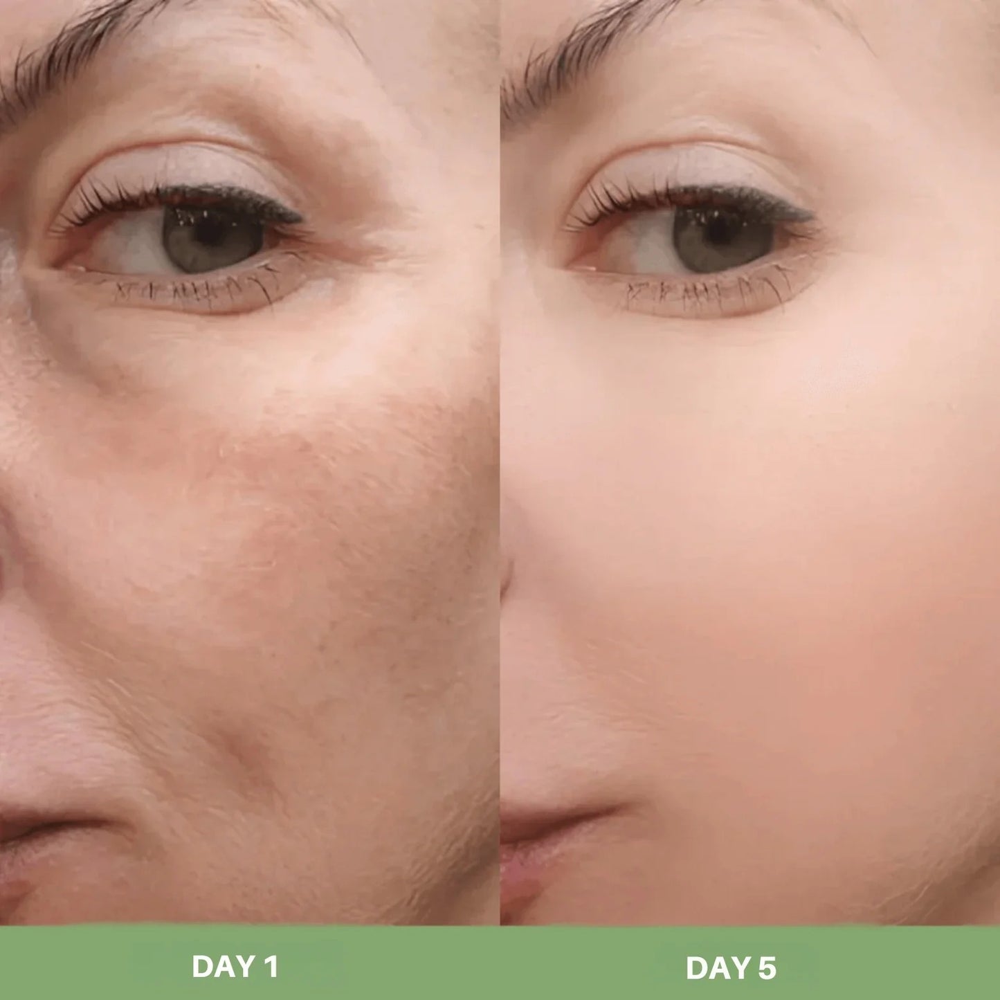 Get Glowing, Brighter Skin in Just 7 Days