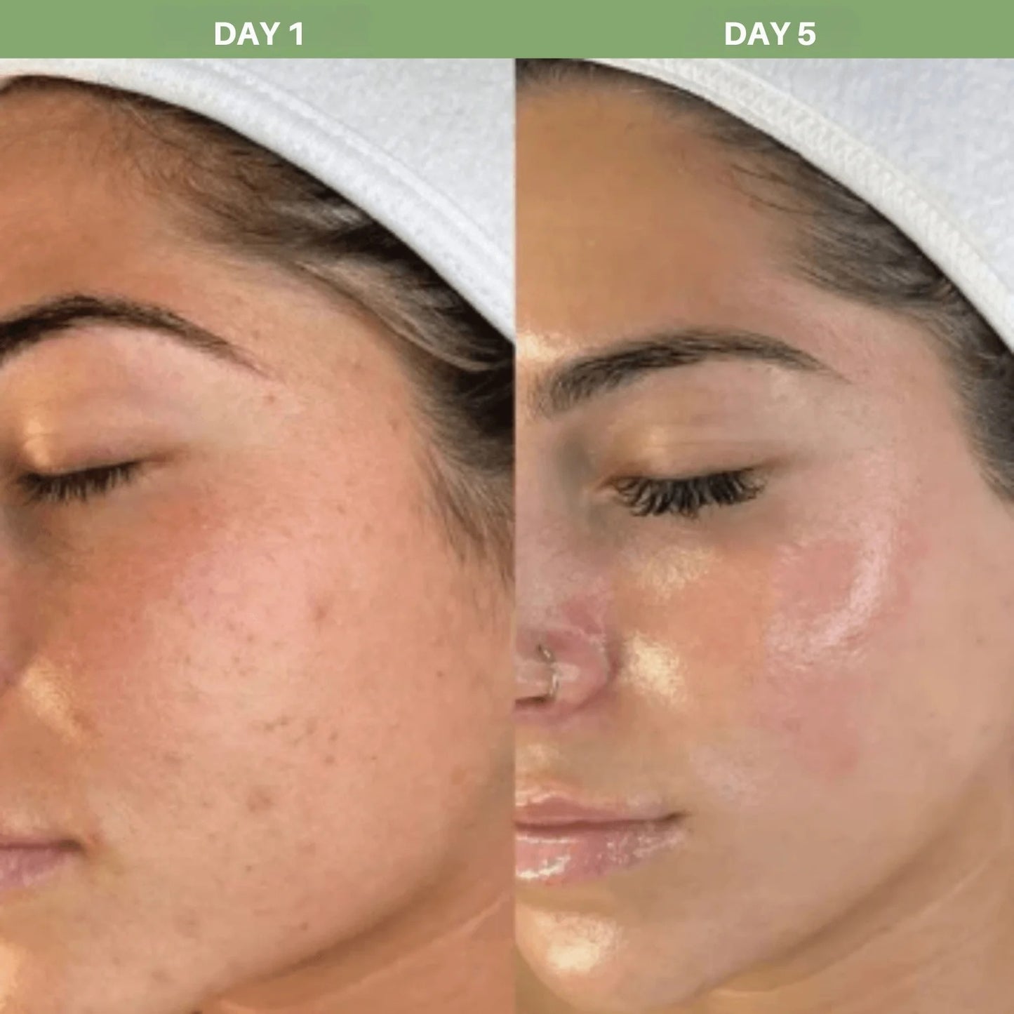 Get Glowing, Brighter Skin in Just 7 Days