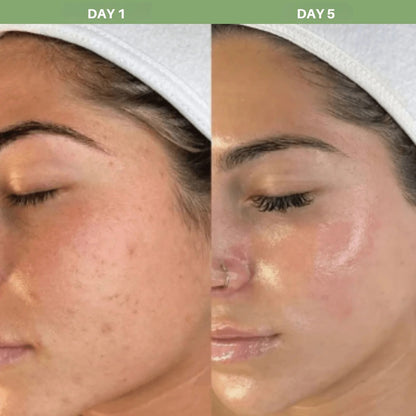 Get Glowing, Brighter Skin in Just 7 Days